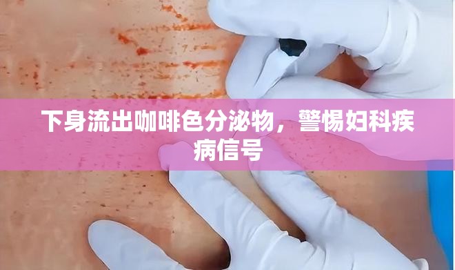 下身流出咖啡色分泌物，警惕婦科疾病信號(hào)