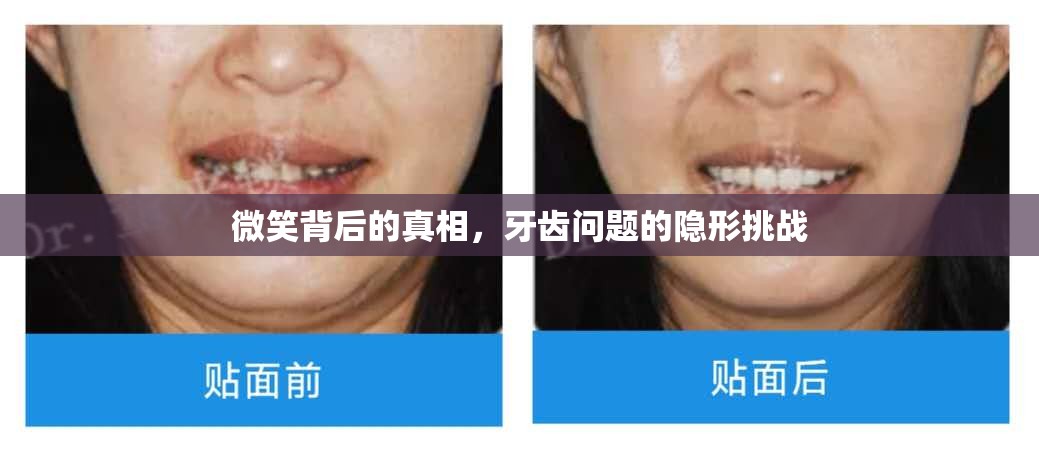 微笑背后的真相，牙齒問題的隱形挑戰(zhàn)