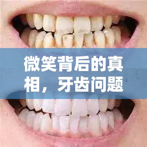 微笑背后的真相，牙齒問題的隱形挑戰(zhàn)