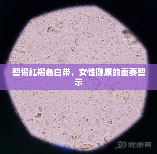 警惕紅褐色白帶，女性健康的重要警示