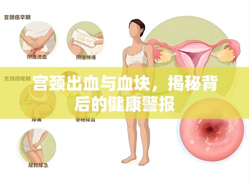 宮頸出血與血塊，揭秘背后的健康警報