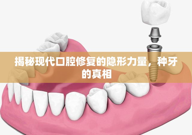 揭秘現(xiàn)代口腔修復(fù)的隱形力量，種牙的真相