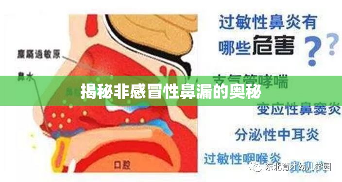 揭秘非感冒性鼻漏的奧秘
