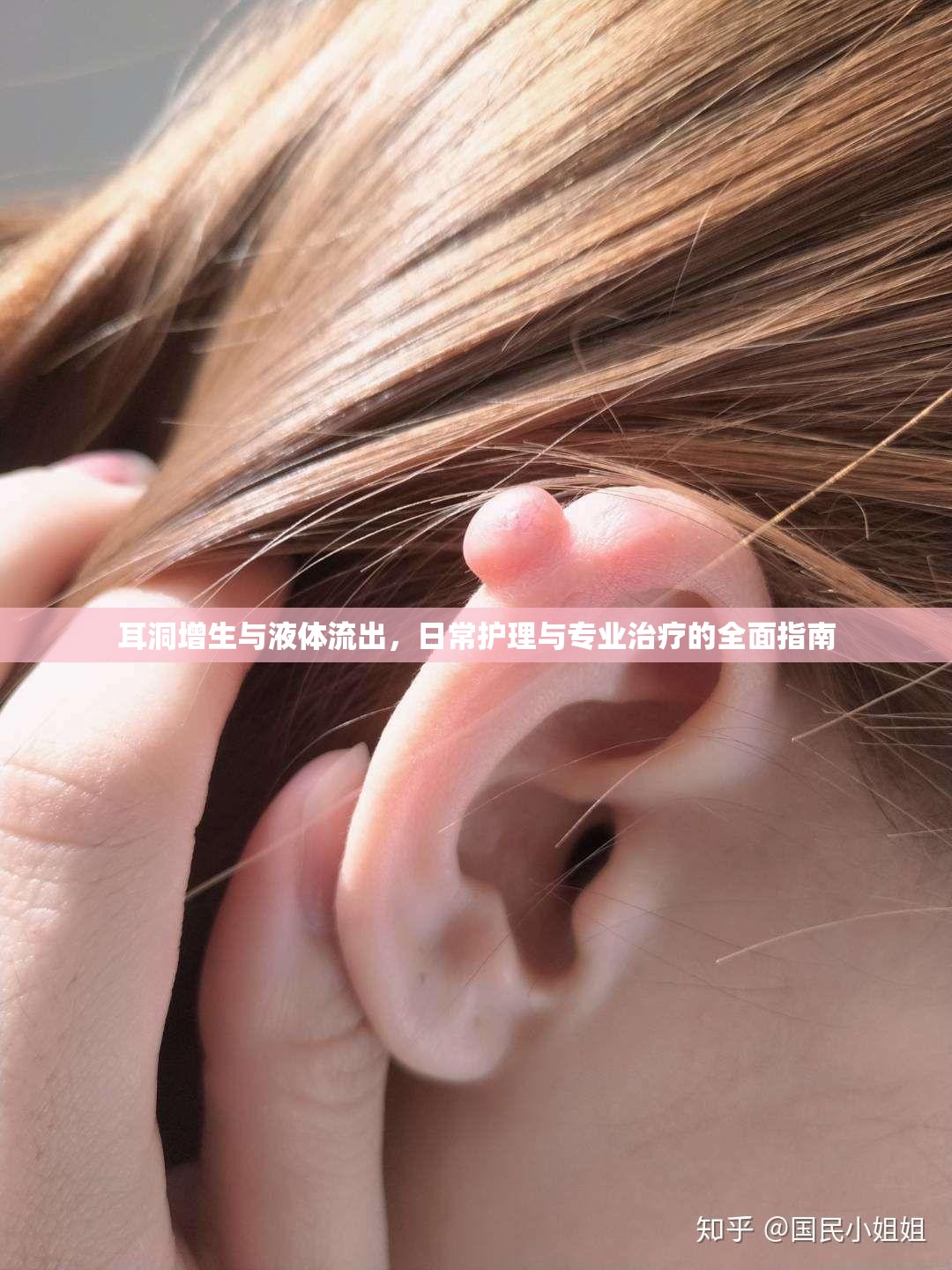 耳洞增生與液體流出，日常護(hù)理與專業(yè)治療的全面指南