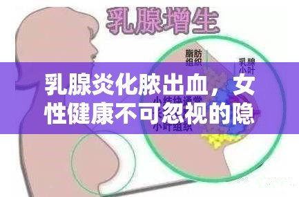 乳腺炎化膿出血，女性健康不可忽視的隱形威脅