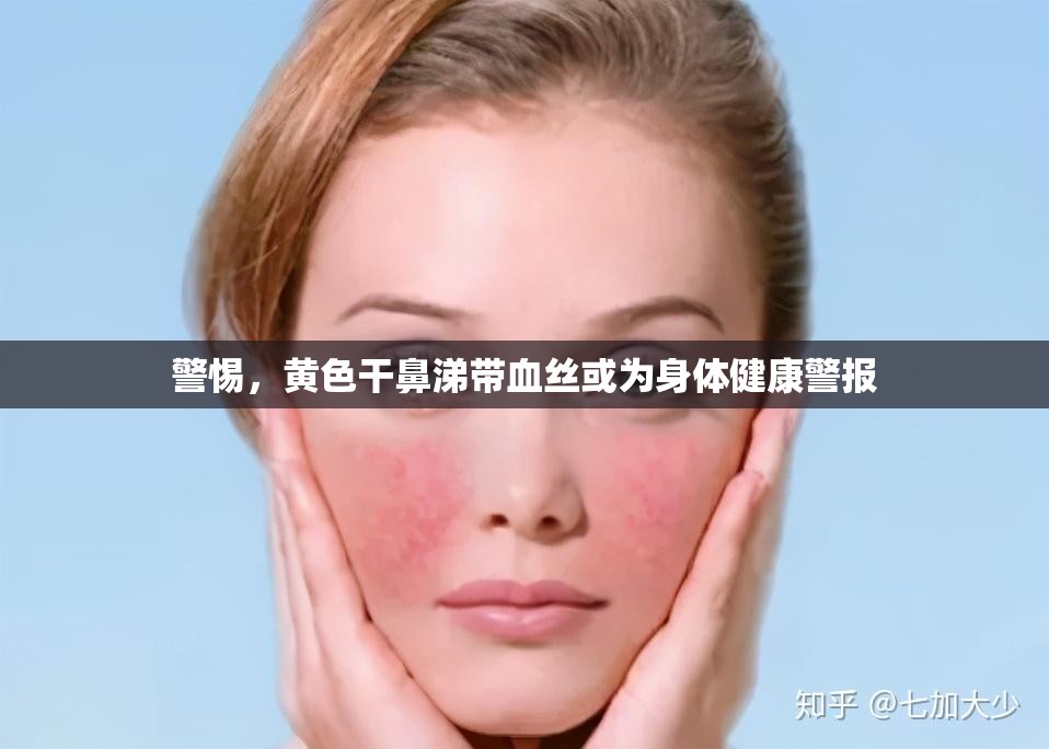 警惕，黃色干鼻涕帶血絲或?yàn)樯眢w健康警報(bào)