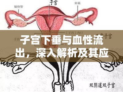 子宮下垂與血性流出，深入解析及其應(yīng)對(duì)策略