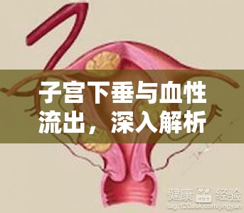 子宮下垂與血性流出，深入解析及其應(yīng)對(duì)策略