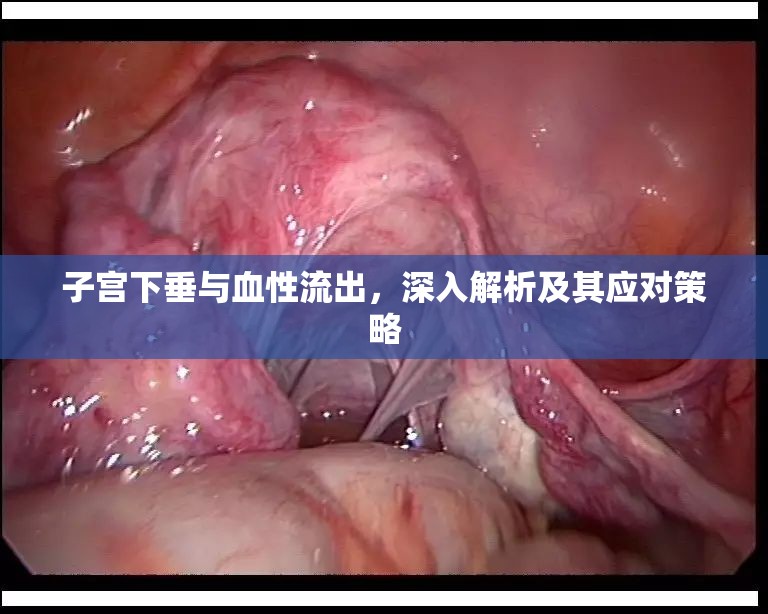 子宮下垂與血性流出，深入解析及其應(yīng)對(duì)策略