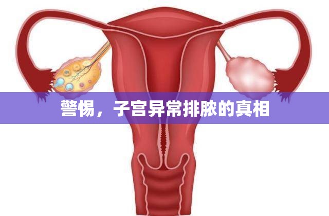 警惕，子宮異常排膿的真相