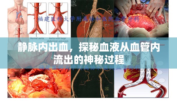 靜脈內出血，探秘血液從血管內流出的神秘過程