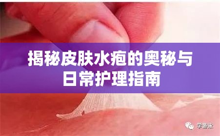 揭秘皮膚水皰的奧秘與日常護理指南