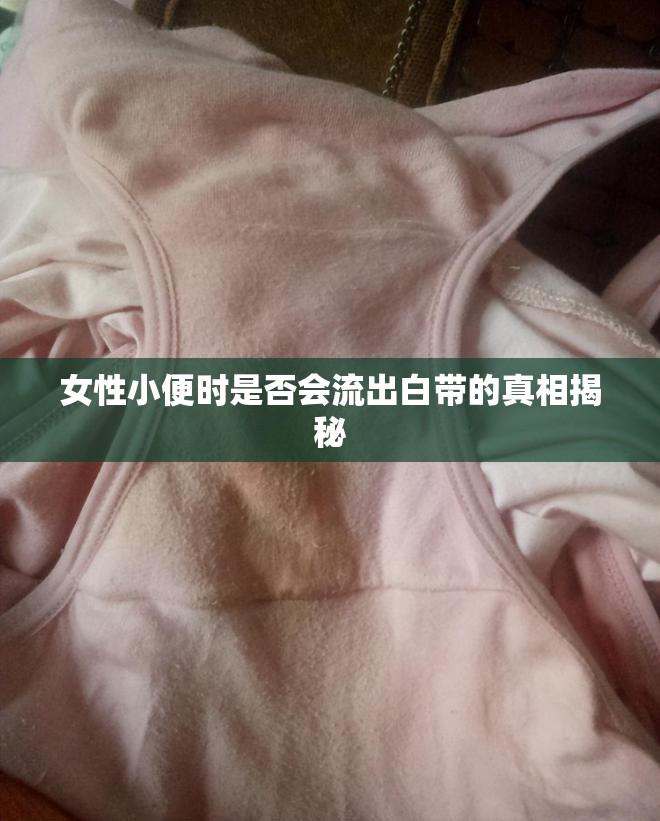 女性小便時是否會流出白帶的真相揭秘