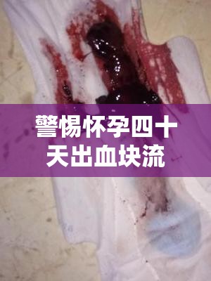 警惕懷孕四十天出血塊流出，先兆流產(chǎn)的信號