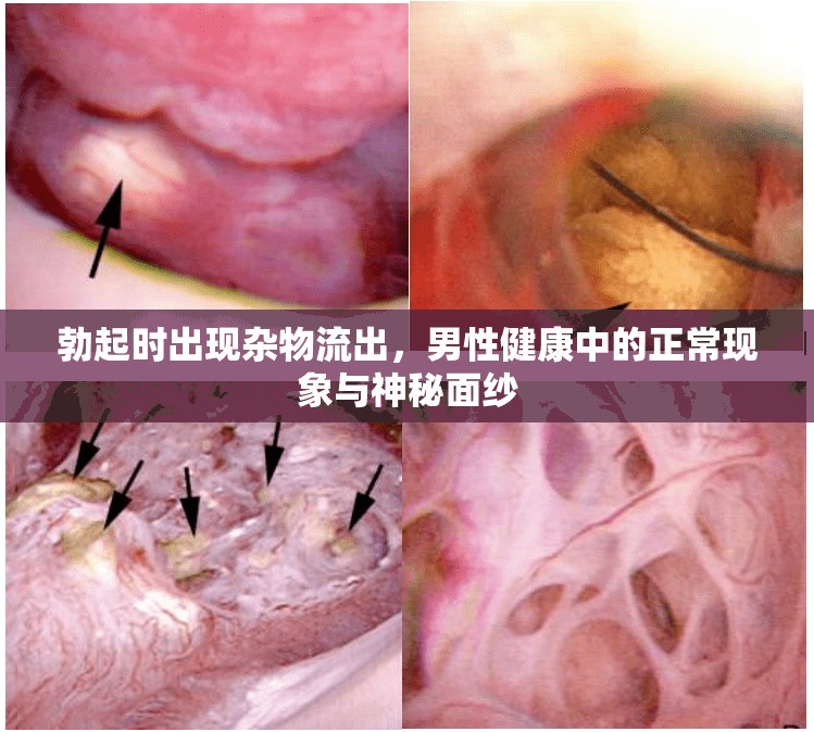 勃起時(shí)出現(xiàn)雜物流出，男性健康中的正常現(xiàn)象與神秘面紗