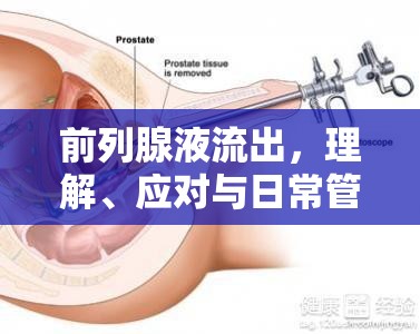 前列腺液流出，理解、應(yīng)對(duì)與日常管理指南