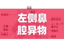 左側(cè)鼻腔異物流出的神秘探索與解謎