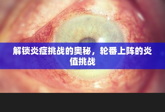 解鎖炎癥挑戰(zhàn)的奧秘，輪番上陣的炎值挑戰(zhàn)