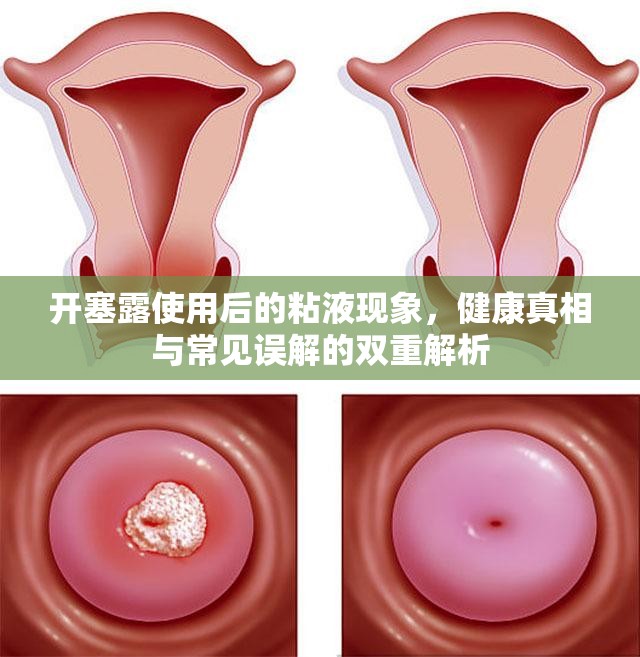 開塞露使用后的粘液現(xiàn)象，健康真相與常見誤解的雙重解析