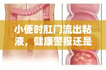 小便時肛門流出粘液，健康警報還是日?，F(xiàn)象？