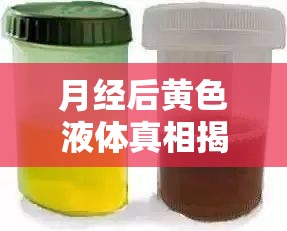 月經(jīng)后黃色液體真相揭秘，解讀月經(jīng)剛走后的異常分泌物