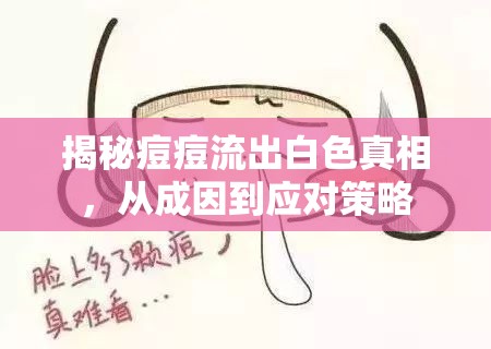 揭秘痘痘流出白色真相，從成因到應(yīng)對(duì)策略