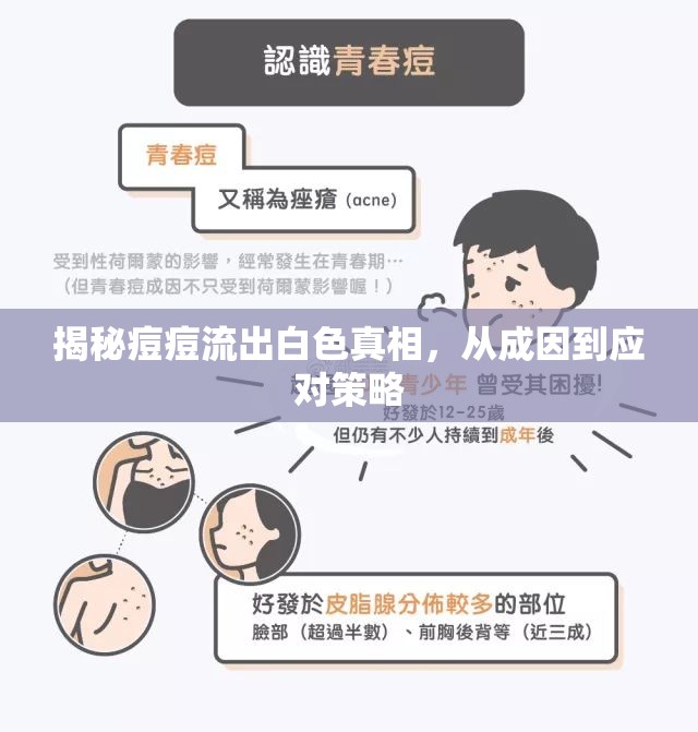 揭秘痘痘流出白色真相，從成因到應(yīng)對(duì)策略