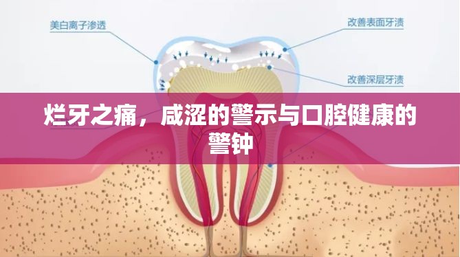爛牙之痛，咸澀的警示與口腔健康的警鐘