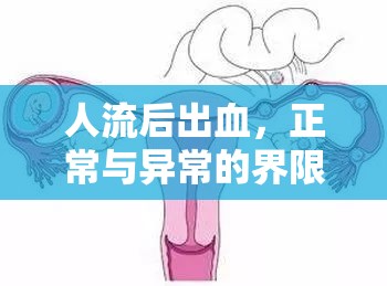 人流后出血，正常與異常的界限解析
