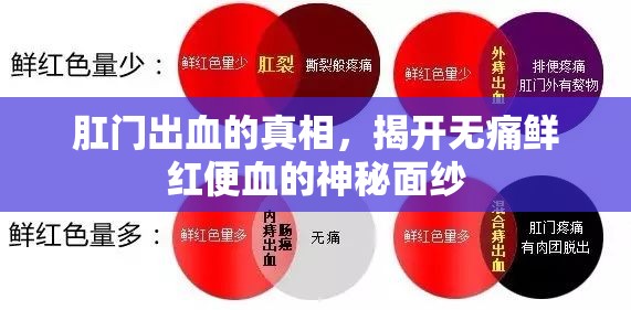 肛門出血的真相，揭開無痛鮮紅便血的神秘面紗