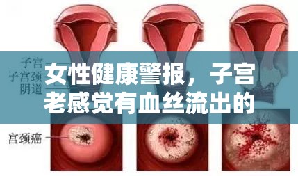 女性健康警報，子宮老感覺有血絲流出的應(yīng)對策略