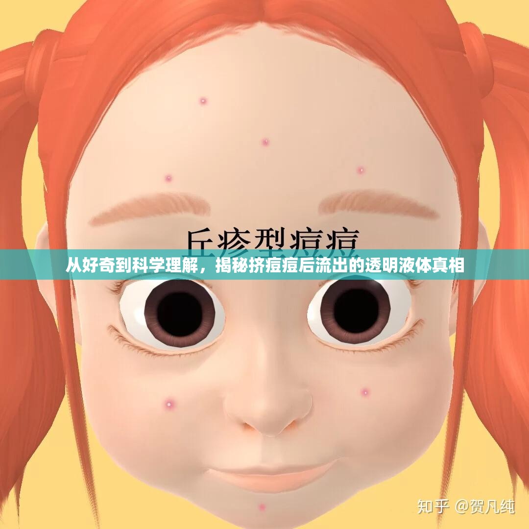 從好奇到科學(xué)理解，揭秘?cái)D痘痘后流出的透明液體真相