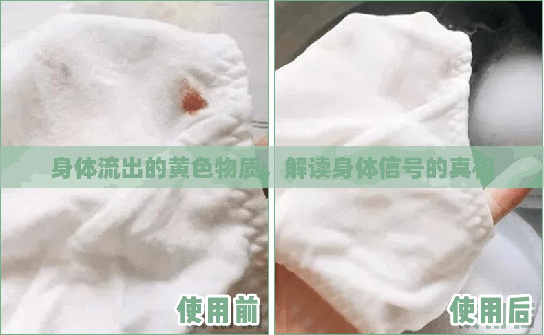 身體流出的黃色物質(zhì)，解讀身體信號(hào)的真相