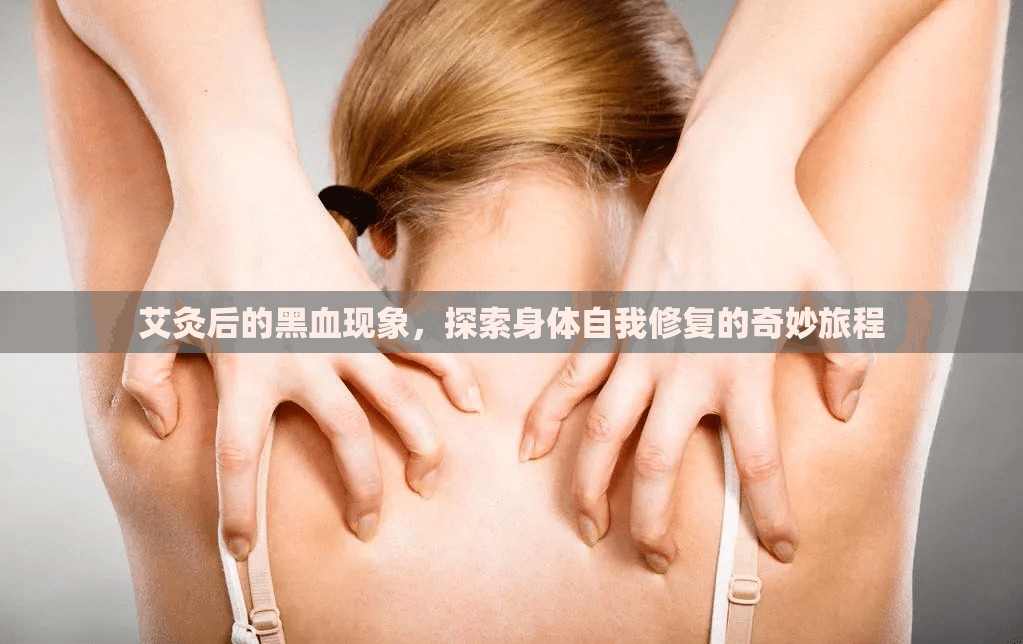 艾灸后的黑血現(xiàn)象，探索身體自我修復的奇妙旅程