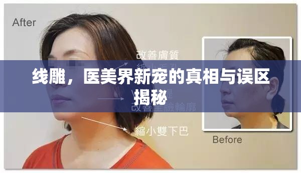 線雕，醫(yī)美界新寵的真相與誤區(qū)揭秘