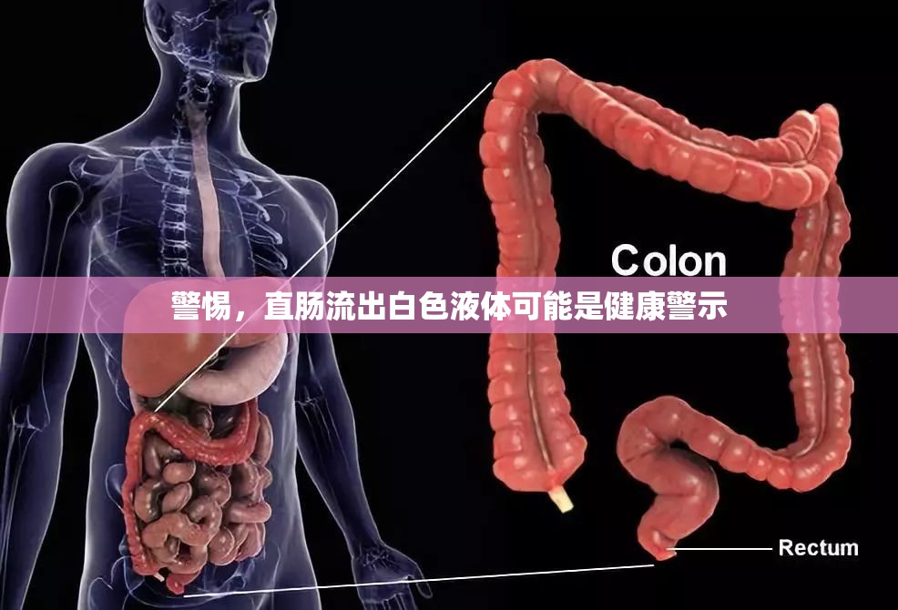 警惕，直腸流出白色液體可能是健康警示