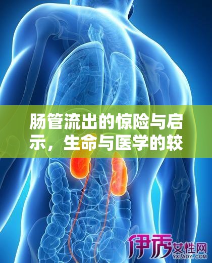 腸管流出的驚險與啟示，生命與醫(yī)學的較量