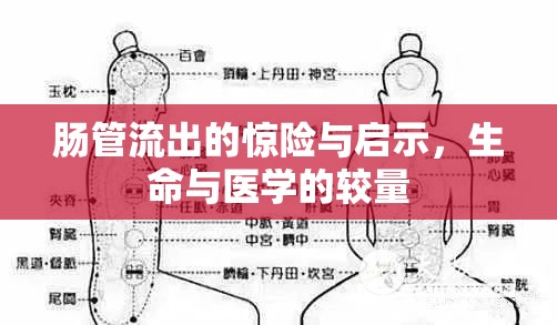 腸管流出的驚險與啟示，生命與醫(yī)學的較量