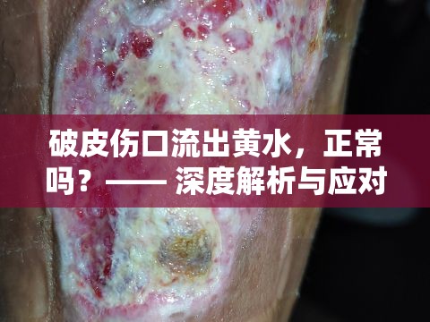 破皮傷口流出黃水，正常嗎？—— 深度解析與應(yīng)對指南
