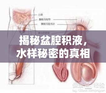 揭秘盆腔積液，水樣秘密的真相