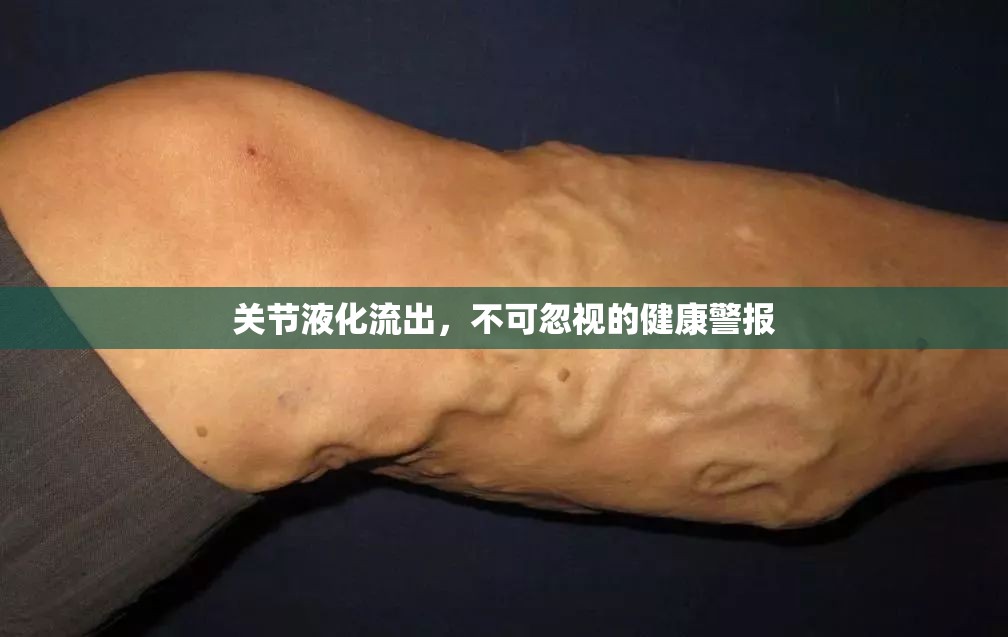關(guān)節(jié)液化流出，不可忽視的健康警報