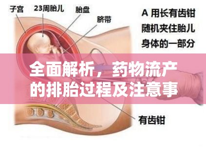 全面解析，藥物流產(chǎn)的排胎過程及注意事項