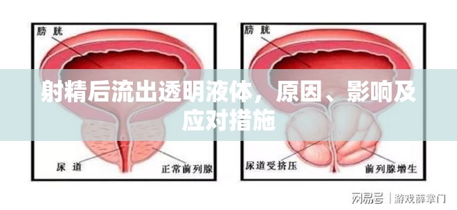 射精后流出透明液體，原因、影響及應(yīng)對措施