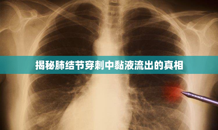 揭秘肺結(jié)節(jié)穿刺中黏液流出的真相