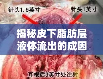 揭秘皮下脂肪層液體流出的成因與應(yīng)對(duì)策略
