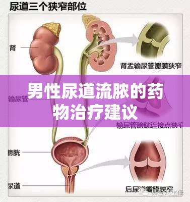 男性尿道流膿的藥物治療建議