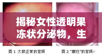 揭秘女性透明果凍狀分泌物，生理現(xiàn)象與健康指南