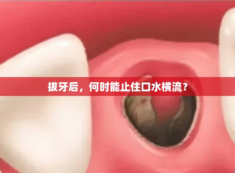 拔牙后，何時能止住口水橫流？