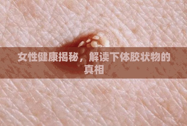 女性健康揭秘，解讀下體膠狀物的真相