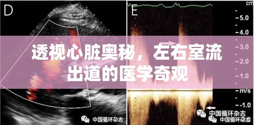 透視心臟奧秘，左右室流出道的醫(yī)學(xué)奇觀